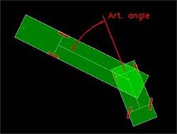 autopath 2016 thumb articulation angle